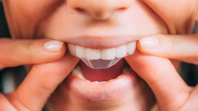 How to Use Crest White Strips