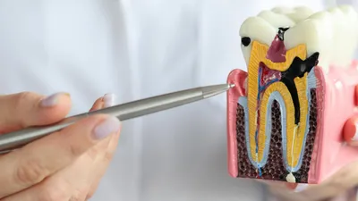 Cavity vs. Stain: How to Tell the Difference