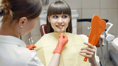 Veneers Process: What to Expect When Getting Dental Veneers