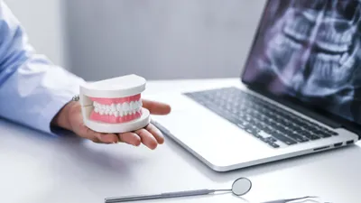 What Is a Deep Bite (Deep Overbite)?