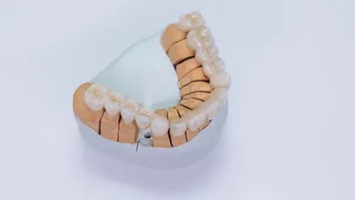 Loose Crown