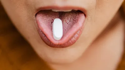 What Is Burning Mouth Syndrome?