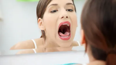 Swollen Tonsils - Symptoms, Causes & Treatments
