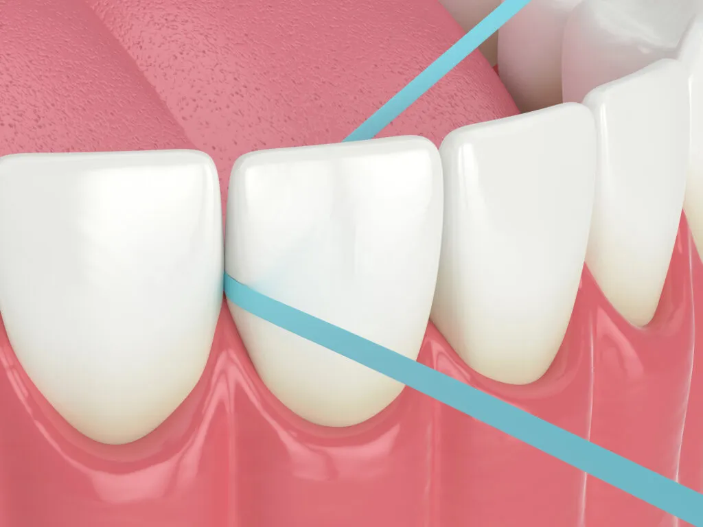 3d render of lower teeth being flossed with dental floss