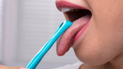 The Best Tongue Scrapers for Fresher Breath & Improved Health