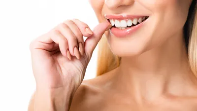 Instasmile Snap On Veneers Review