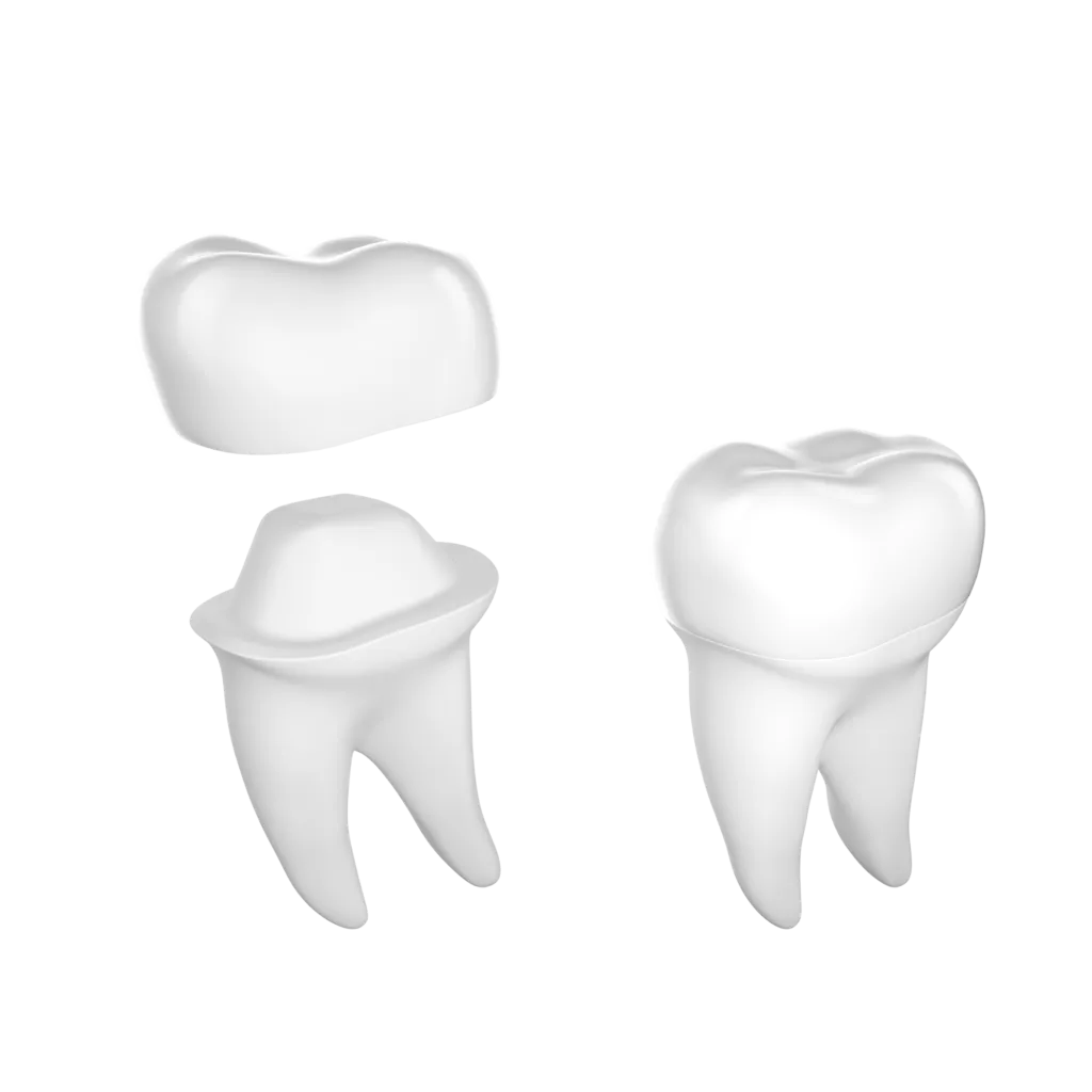 Dental Crown Porcelain