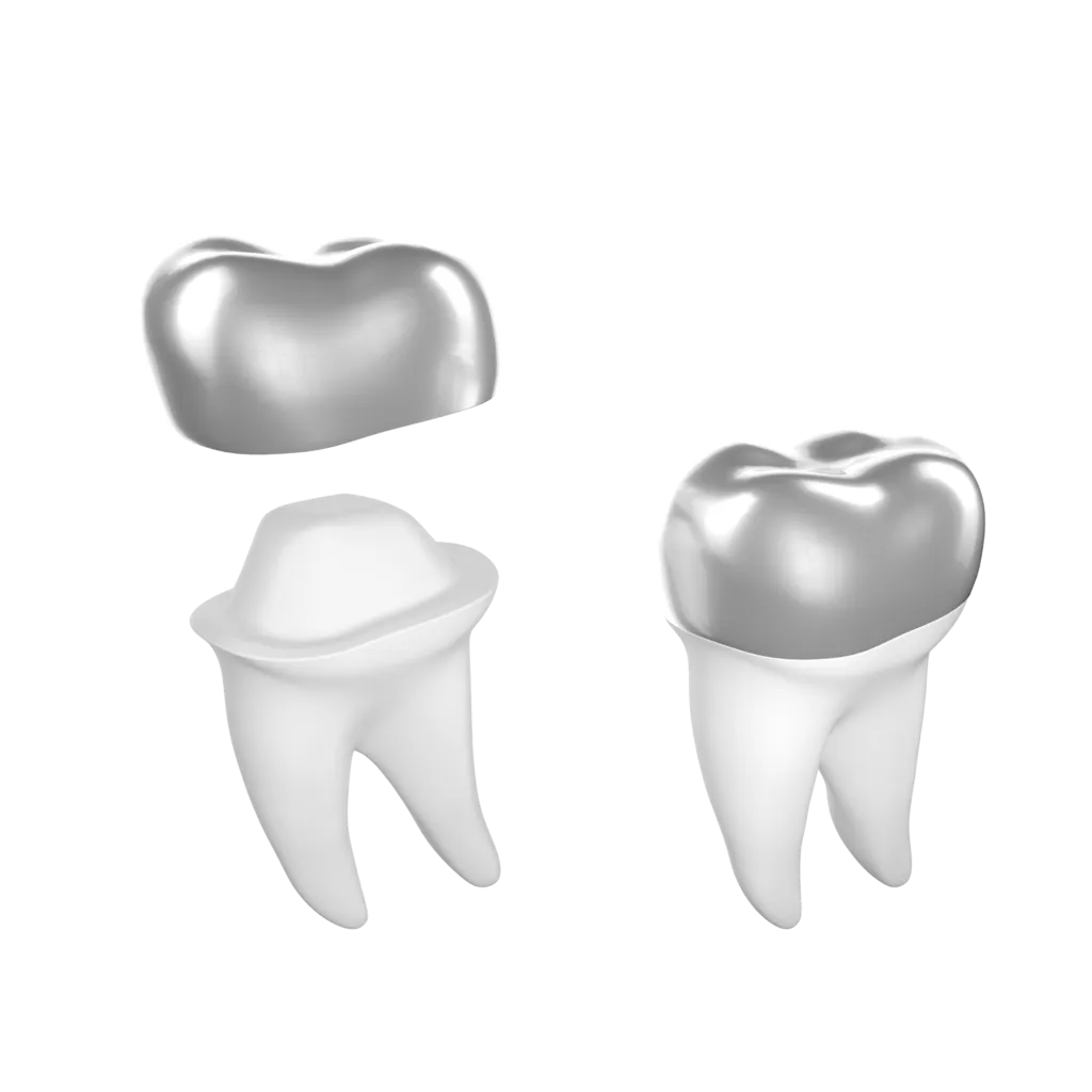 Dental Crown Silver