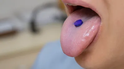 Plaque Disclosing Tablets