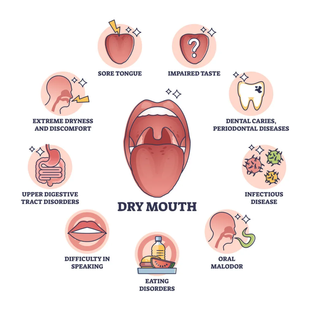 Dry mouth or xerostomia illustrations of symptoms