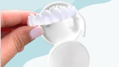 Secret Veneers Review (2026)