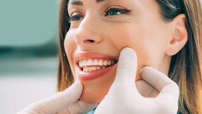 No Prep Veneers - Procedures, Pros, Cons, Costs & Alternatives