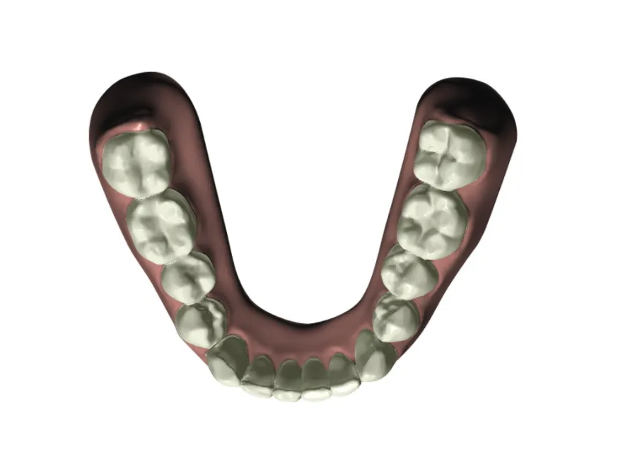 After newsmile bottom