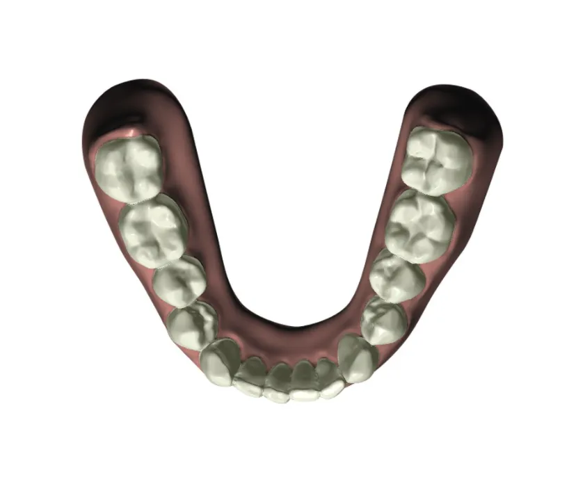 Before newsmile bottom