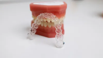 How Much Do Clear Aligners Cost?