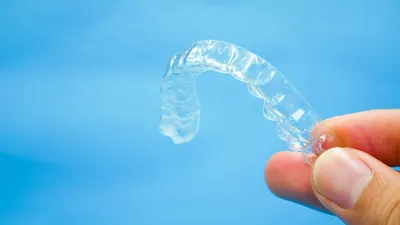 Can You Order Retainers Online?