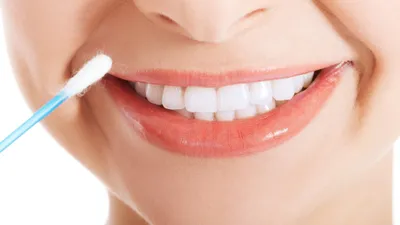 Teeth Whitening Swabs: Pros, Cons, and Cost