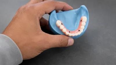 Should I Get All-on-4 Dental Implants?