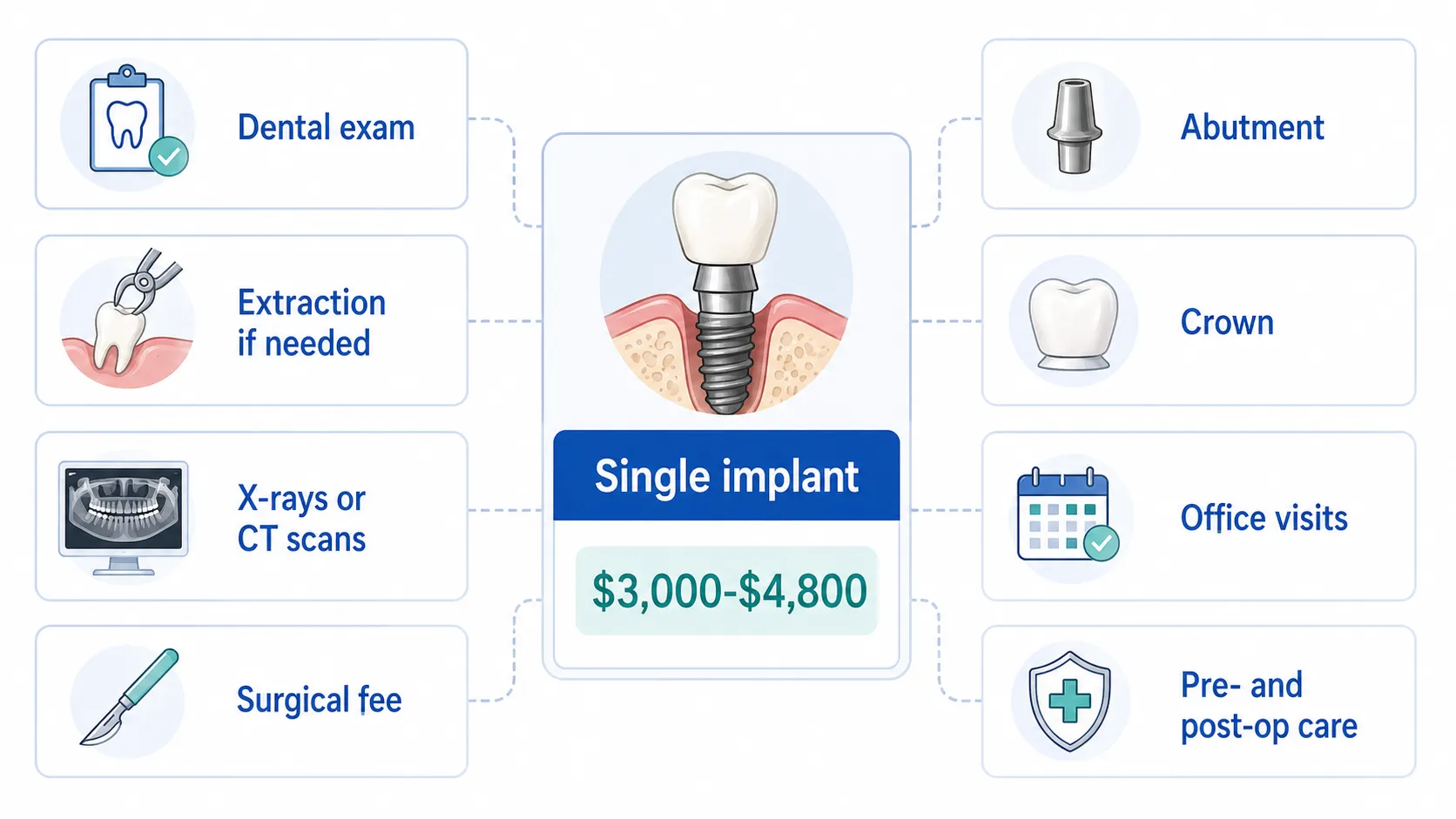 Dental implant cost factor board for common procedure components