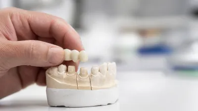 3 on 6 Dental Implants