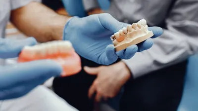 4 Types of Permanent Dentures