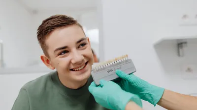 How to Maintain Dental Veneers