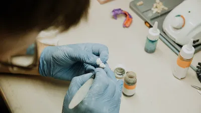 Composite Veneers: Costs, Procedure, Pros, and Cons