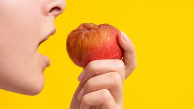 Rotten Teeth: Causes & Treatment