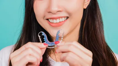 How Long Do You Have to Wear a Retainer?