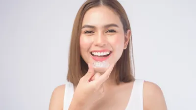 Vivera (Invisalign)