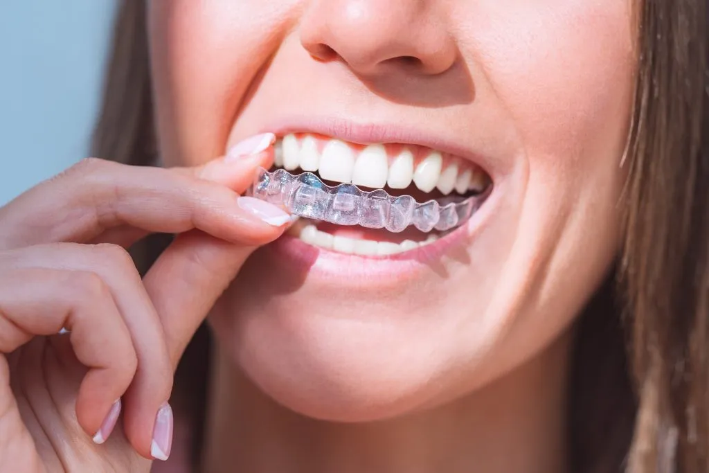 Woman putting clear aligners
