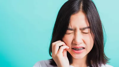 Why Do My Gums Swell With Braces?